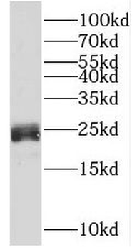 CSH1 Rabbit Polyclonal Antibody