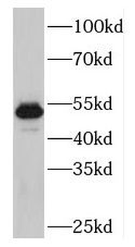 PLAGL1 Rabbit Polyclonal Antibody