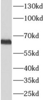 ALPP Mouse Monoclonal Antibody