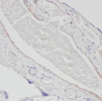 ALPP Mouse Monoclonal Antibody