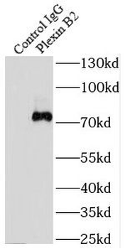 PLXNB2 Rabbit Polyclonal Antibody