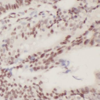 PLK3 Rabbit Polyclonal Antibody