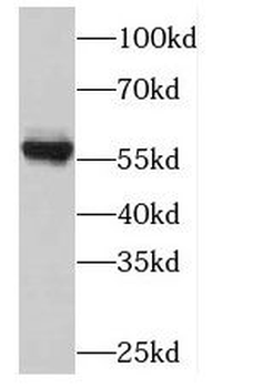PLK5 Rabbit Polyclonal Antibody