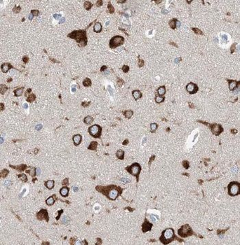 PLK5 Rabbit Polyclonal Antibody