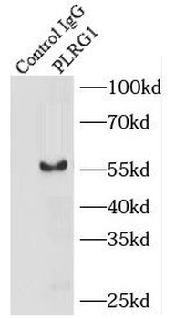 PLRG1 Rabbit Polyclonal Antibody