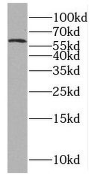 PNLDC1 Rabbit Polyclonal Antibody