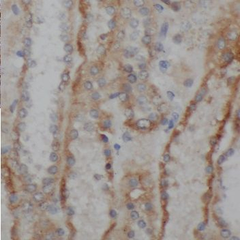 PNLDC1 Rabbit Polyclonal Antibody