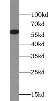 PODXL Rabbit Polyclonal Antibody