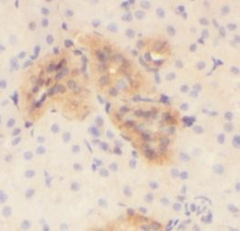 PODXL Rabbit Polyclonal Antibody