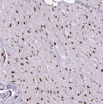 POLD1 Rabbit Polyclonal Antibody