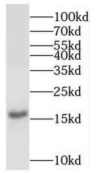 POLE3 Rabbit Polyclonal Antibody