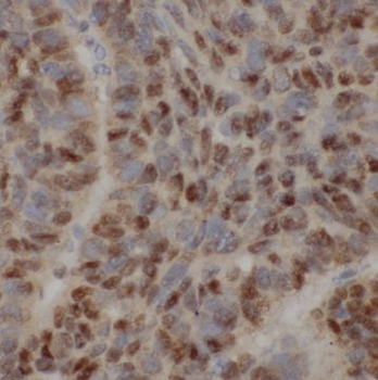 POLE3 Rabbit Polyclonal Antibody
