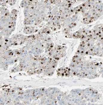 POLI Rabbit Polyclonal Antibody