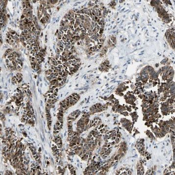POLK Rabbit Polyclonal Antibody