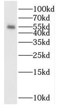POLM Rabbit Polyclonal Antibody
