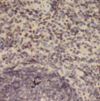 POLM Rabbit Polyclonal Antibody