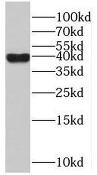 POLR1C Rabbit Polyclonal Antibody