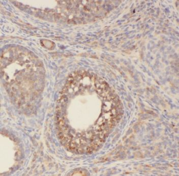 POLR1C Rabbit Polyclonal Antibody