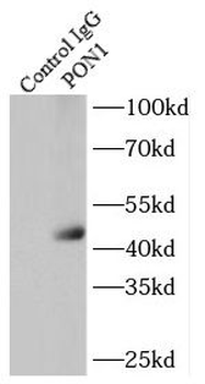 PON1 Rabbit Polyclonal Antibody