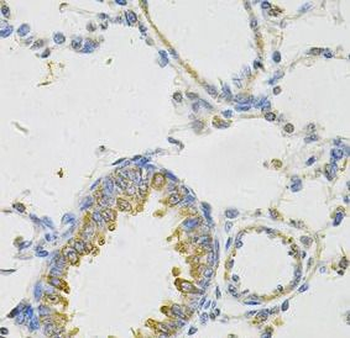 PON2 Rabbit Polyclonal Antibody