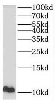 PPBP Rabbit Polyclonal Antibody
