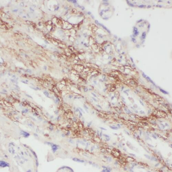 PPBP Rabbit Polyclonal Antibody