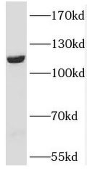 PPFIBP1 Rabbit Polyclonal Antibody