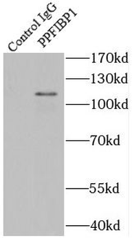 PPFIBP1 Rabbit Polyclonal Antibody