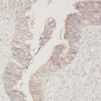 PPFIBP1 Rabbit Polyclonal Antibody