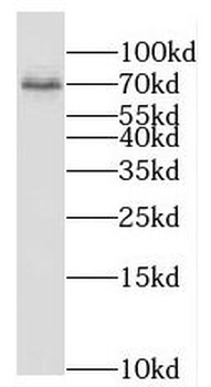 PPM1G Rabbit Polyclonal Antibody