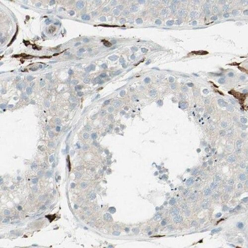 PPM1G Rabbit Polyclonal Antibody