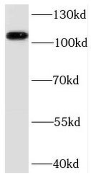 PPP1R13L Rabbit Polyclonal Antibody