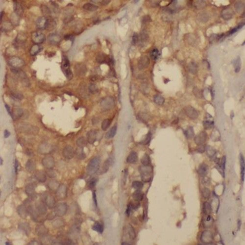 PPP1R13L Rabbit Polyclonal Antibody