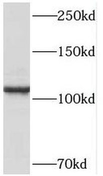 PPP1R13L Rabbit Polyclonal Antibody