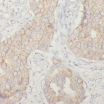 PPP1R13L Rabbit Polyclonal Antibody