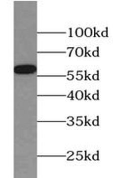 PPP3CA Rabbit Polyclonal Antibody