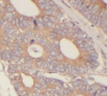 PPP3CA Rabbit Polyclonal Antibody