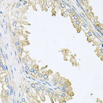 PPP3R1 Rabbit Polyclonal Antibody