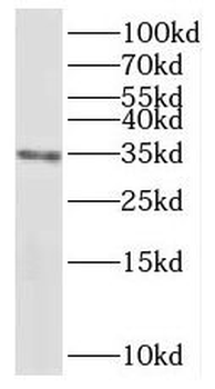 PPP6C Rabbit Polyclonal Antibody