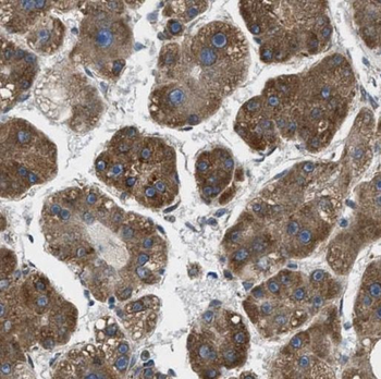 PRAP1 Rabbit Polyclonal Antibody