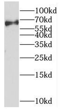 PRC1 Rabbit Polyclonal Antibody
