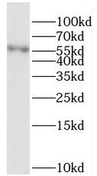 PRCP Rabbit Polyclonal Antibody