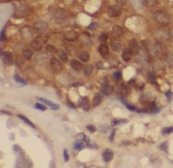 PRDX1 Rabbit Polyclonal Antibody