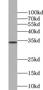PRG2 Rabbit Polyclonal Antibody