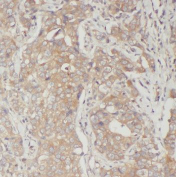 PRG2 Rabbit Polyclonal Antibody