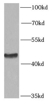 PRKAR1A Rabbit Polyclonal Antibody
