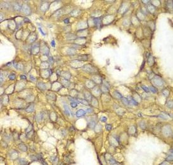 PRKAR1A Rabbit Polyclonal Antibody
