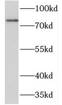 PRKCSH Rabbit Polyclonal Antibody
