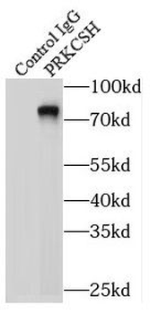 PRKCSH Rabbit Polyclonal Antibody