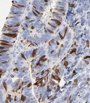 PRKCSH Rabbit Polyclonal Antibody